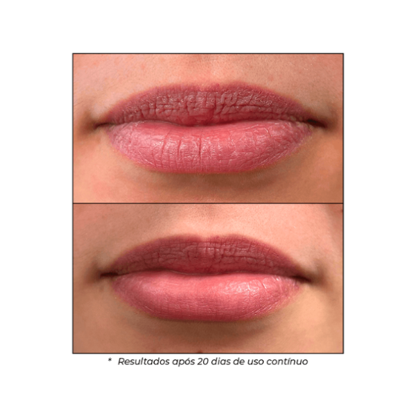 Peptide Lip Treatment Chai - Image 7